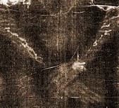 Рана от гвоздя, левая рука